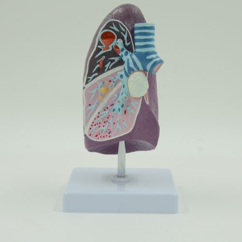 PATHOLOGICAL MODEL OF THE LUNG