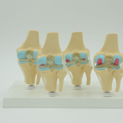 4-STAGE VERTEBRAE MODEL