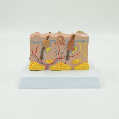 PATHOLOGICAL MODEL OF BURNED SKIN