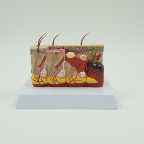PATHOLOGICAL MODEL OF THE SKIN