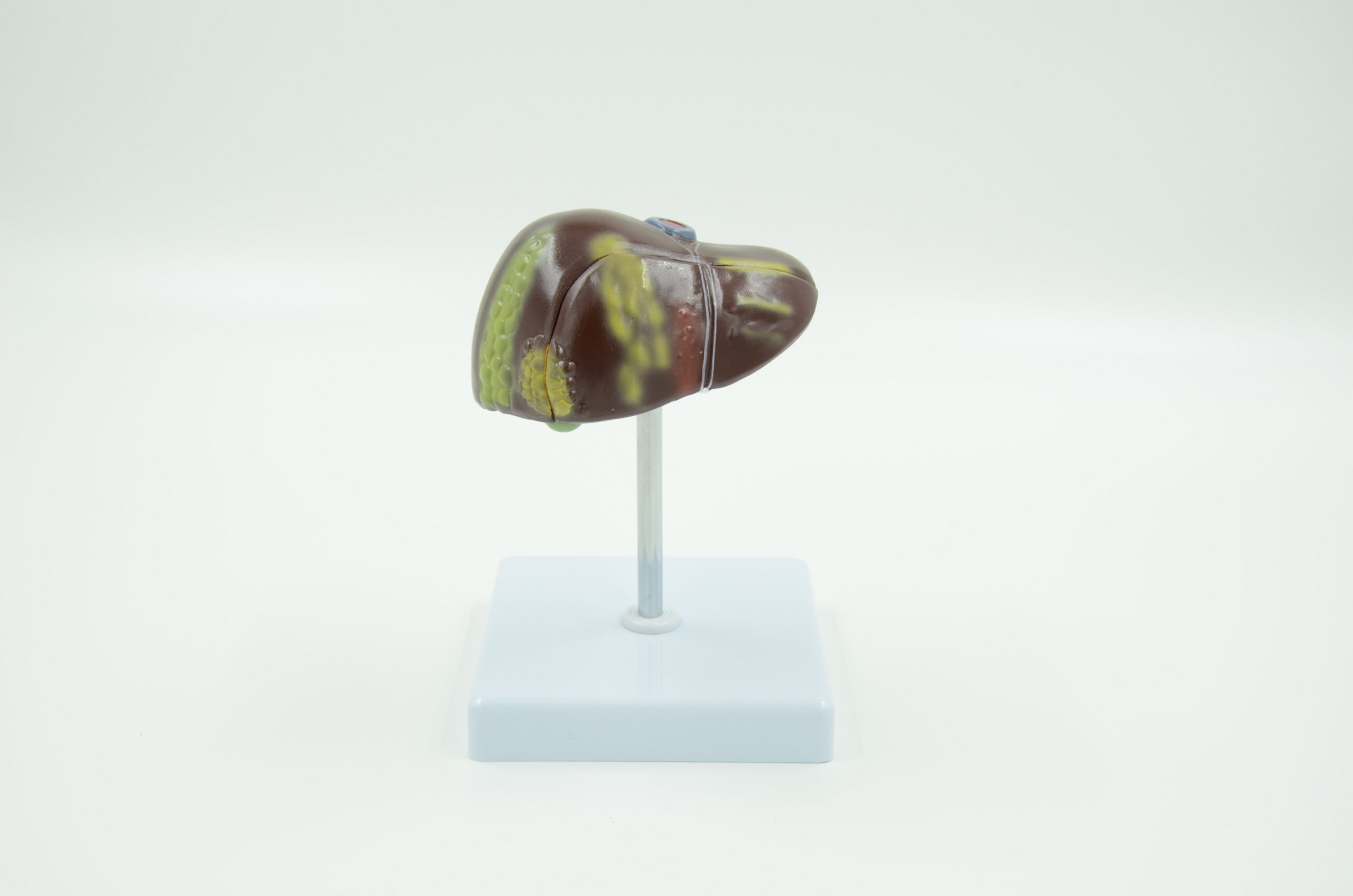 PATHOLOGICAL MODEL OF THE LIVER