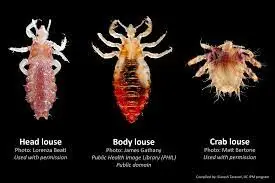Preserved Louse Specimen 5/Pack