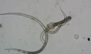 Vinegar Eel Anguilla Aceti